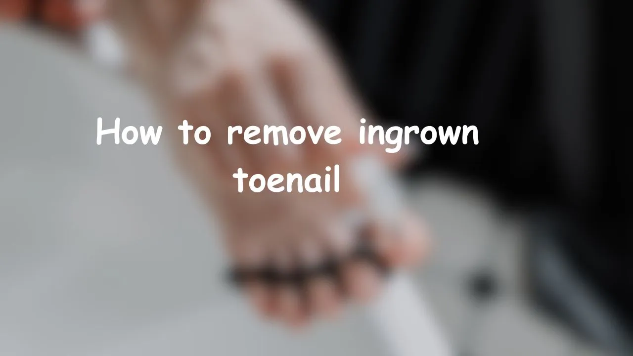 how to remove ingrown toenail