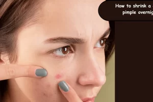 how to shrink a cystic pimple overnight