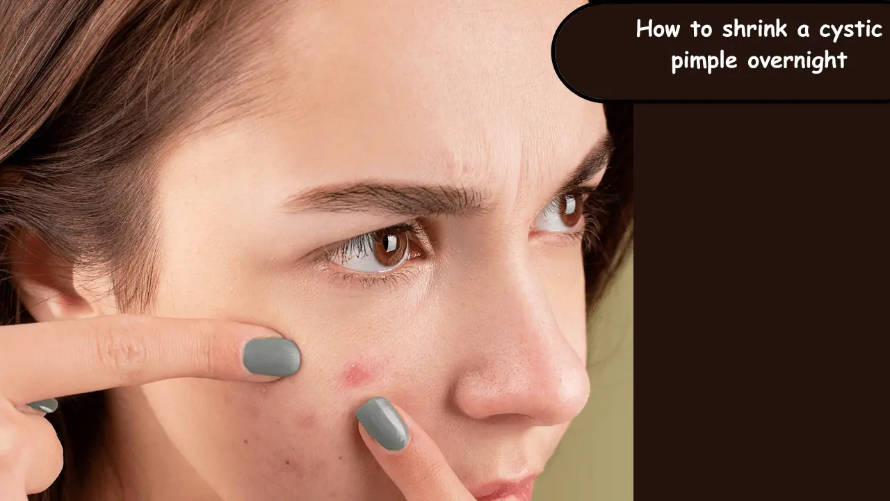 how to shrink a cystic pimple overnight